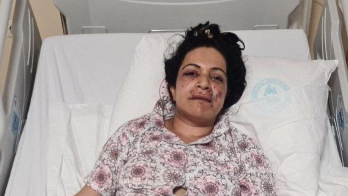 Sarıyer’de silahla ağzından vurulan kadın hastaneye kaldırıldı