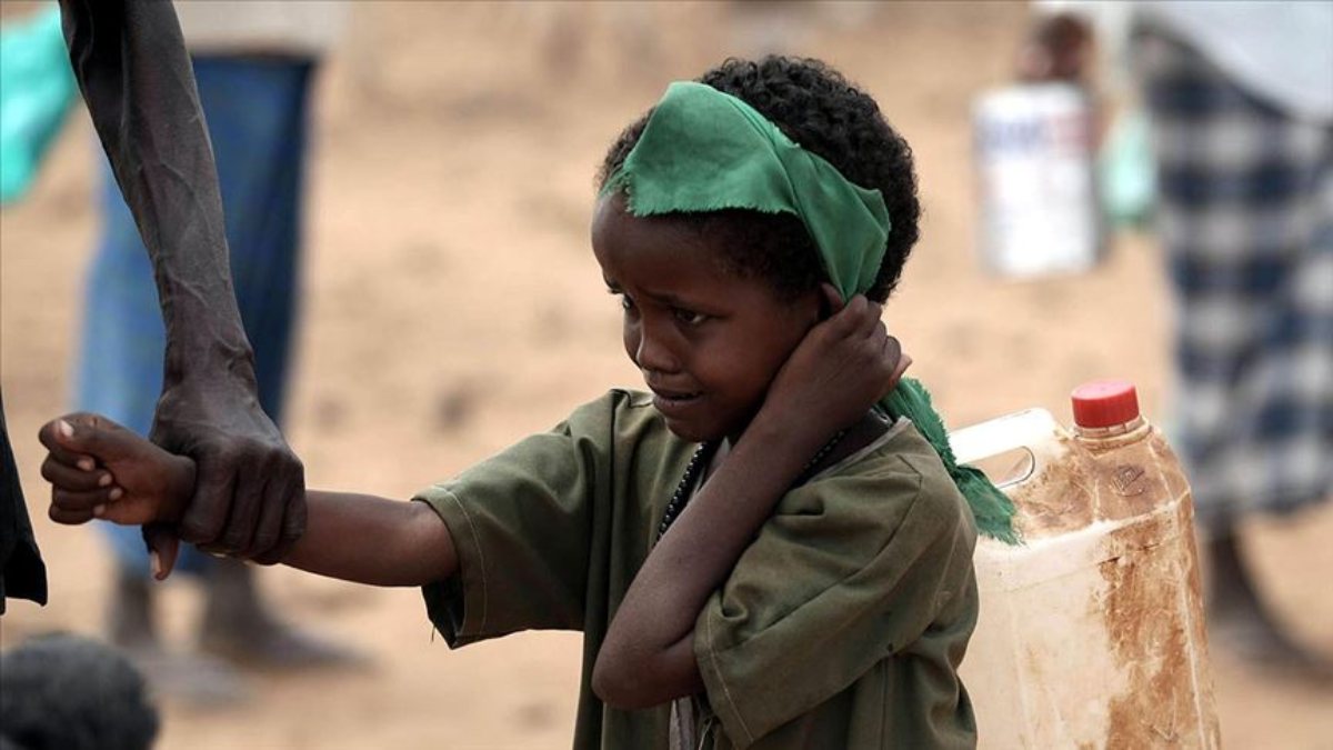 BM: Doğu Afrika’daki çocuk ölümlerinde patlama yaşanabilir